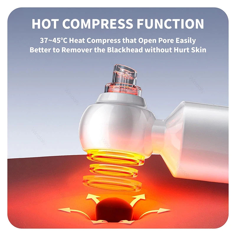 Hydrating Blackhead Remover Pore Vacuum With Hot Compress
