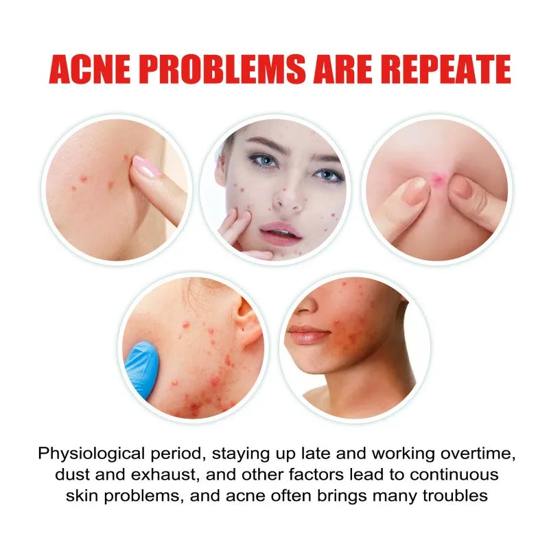 Star Acne Patches Invisible Pimple Dots for Blemishes