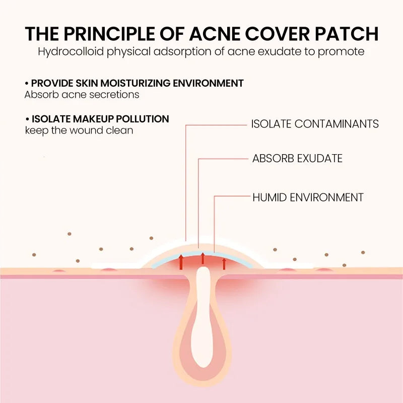 Star Acne Patches Invisible Pimple Dots for Blemishes