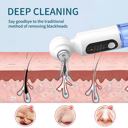 Hydrating Blackhead Remover Pore Vacuum With Hot Compress