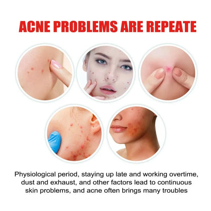 Star Acne Patches Invisible Pimple Dots for Blemishes