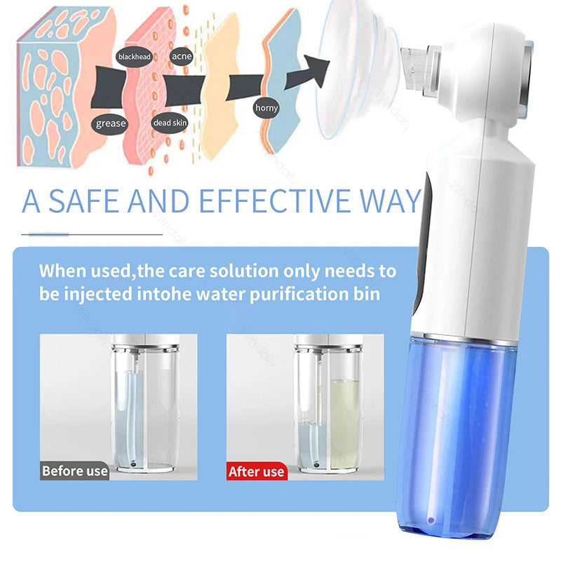 Hydrating Blackhead Remover Pore Vacuum With Hot Compress